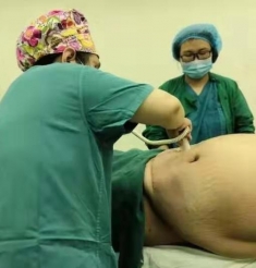 “重量级”高危产妇在我院顺利生产，母女平安